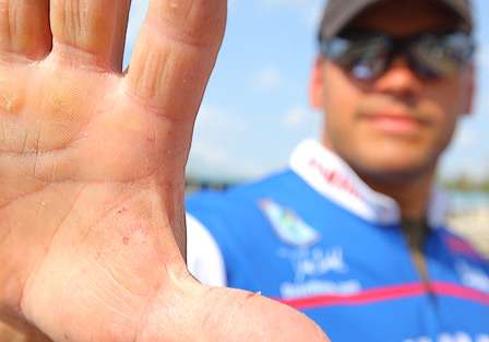 Dave Wolak's thumb got a workout from all the fish he caught.
