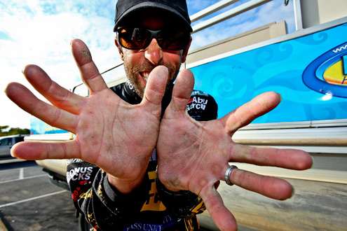<p>
	 </p>
<p>
	Iaconelliâs hands were torn up from catching so many Oneida Lake bass. </p>
