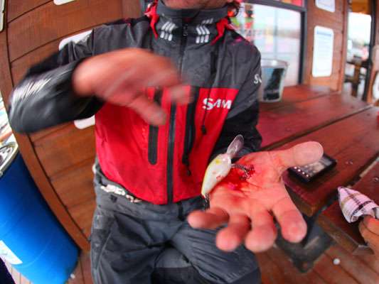 
<p>
	Byron Velvick holds out his hand after hooking himself with a crankbait in the early hours of Day Two of the Elite Series Douglas Lake Challenge.</p>
