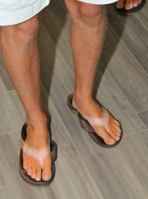 <p>Nummy showed off how much time heâs spent outside in those flip-flops â¦ without adequate sunscreen.</p>
