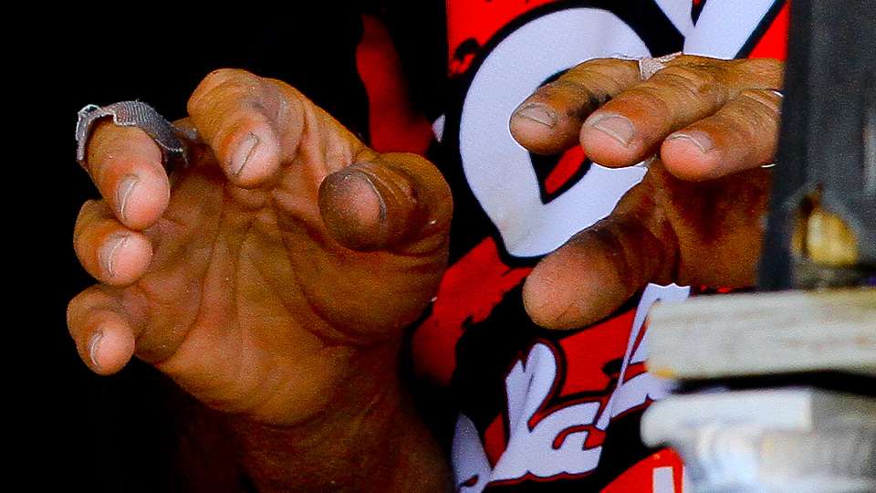 A closer look at the damage done to Mike Iaconelli's hands this week. 