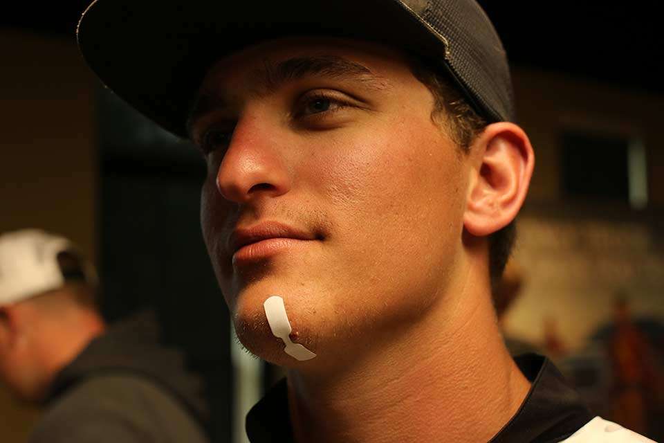 Youngstown State Universityâs Jared Latone claimed the first injury of the week, yanking a tungsten weight from a bush and leaving a nice cut on his chin. A trip to Walmart for a first aid kit has him on the mend. (Donât tell his mom the nearly inch-long gash probably should have required stitches.)